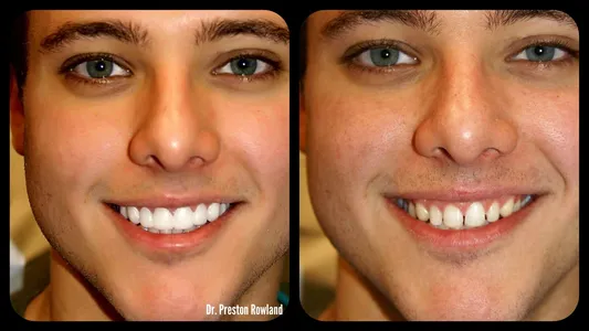 A before and after picture of a man 's teeth.