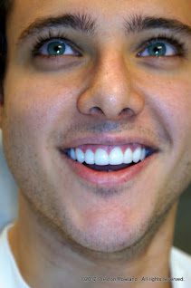 A man with white teeth smiling for the camera.